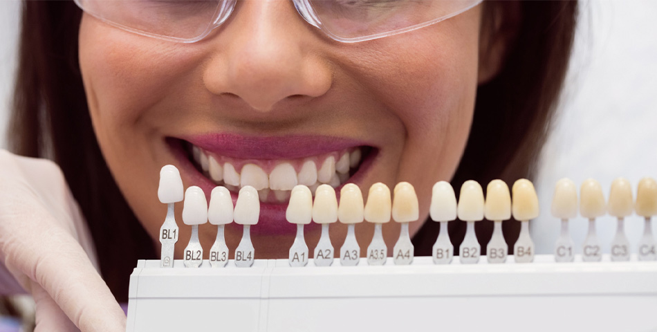 Коронки на зубы