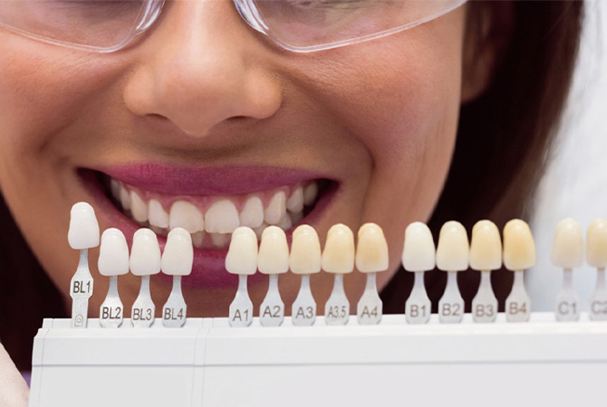 Коронки на зуби