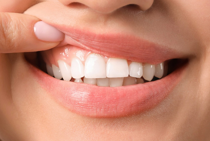 Лікування пародонтиту