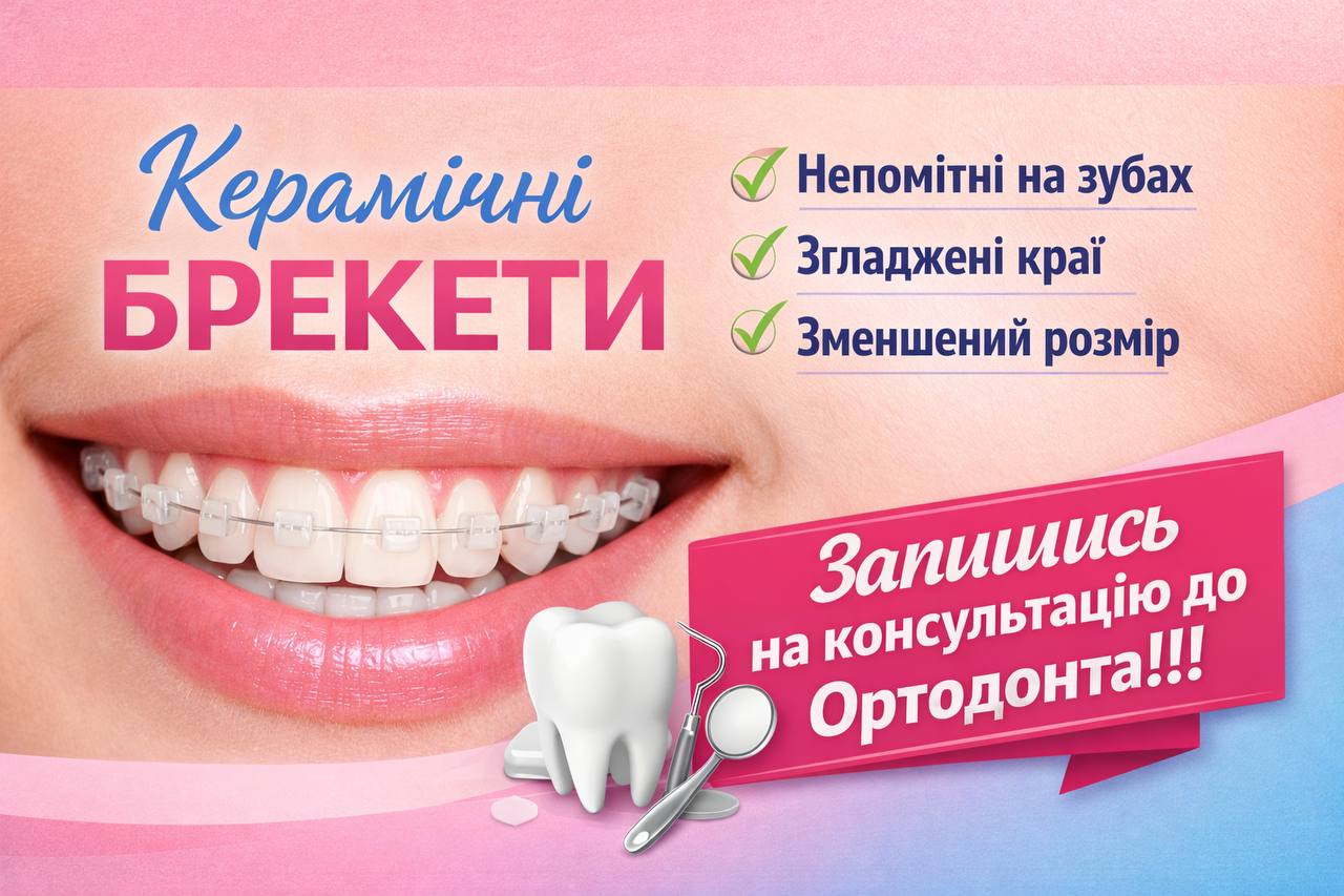 Керамичные брекеты